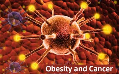 Obesity and Cancer Risk