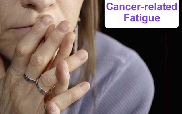 Cancer-related Fatigue- Signs, Causes and how to manage it