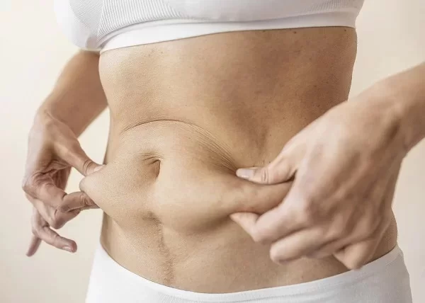 What Do You Need To Know About Liposuction?