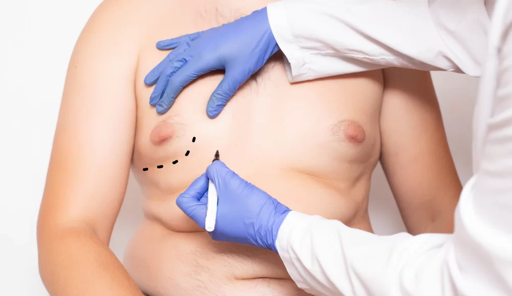 Male Breast Correction