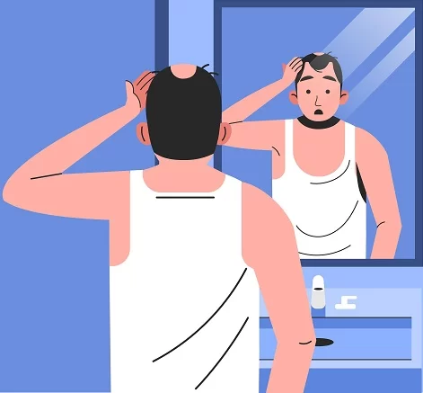 Reasons To Consider Getting A Hair Transplant