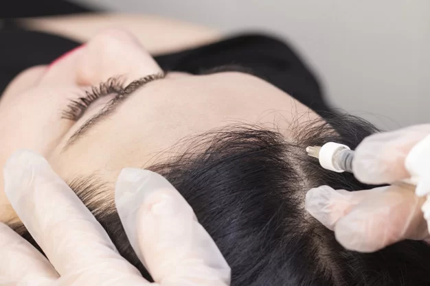What To Expect During A Hair Transplant?