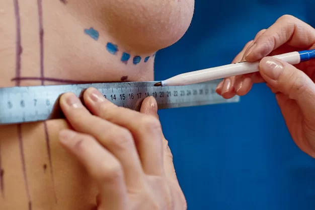 Mastopexy: What is it